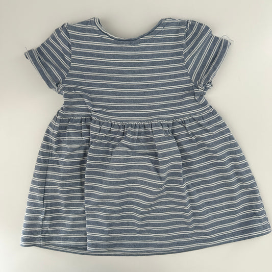 Baby Kleid Streifen Tasche Gr. 68